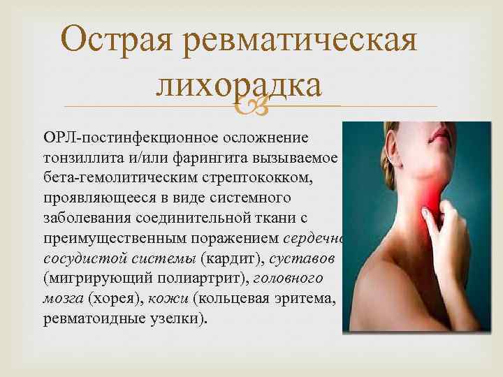 Острая ревматическая лихорадка ОРЛ-постинфекционное осложнение тонзиллита и/или фарингита вызываемое бета-гемолитическим стрептококком, проявляющееся в виде