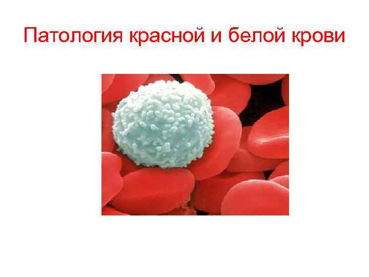 Имеют белые красные и. Нарушения системы белой крови. Патология красной и белой крови. Патология белой крови презентация. Лекция 