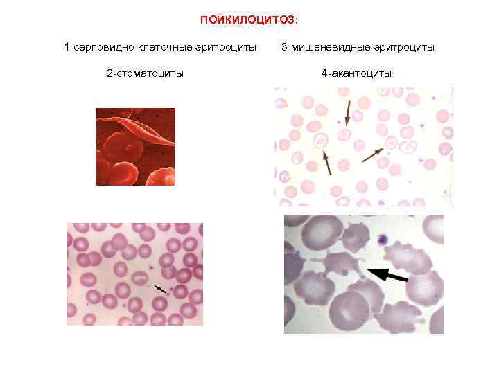 Посмотрите на изображение эритроцитов в разной среде в каком