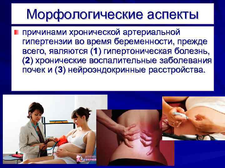 Морфологические аспекты причинами хронической артериальной гипертензии во время беременности, прежде всего, являются (1) гипертоническая