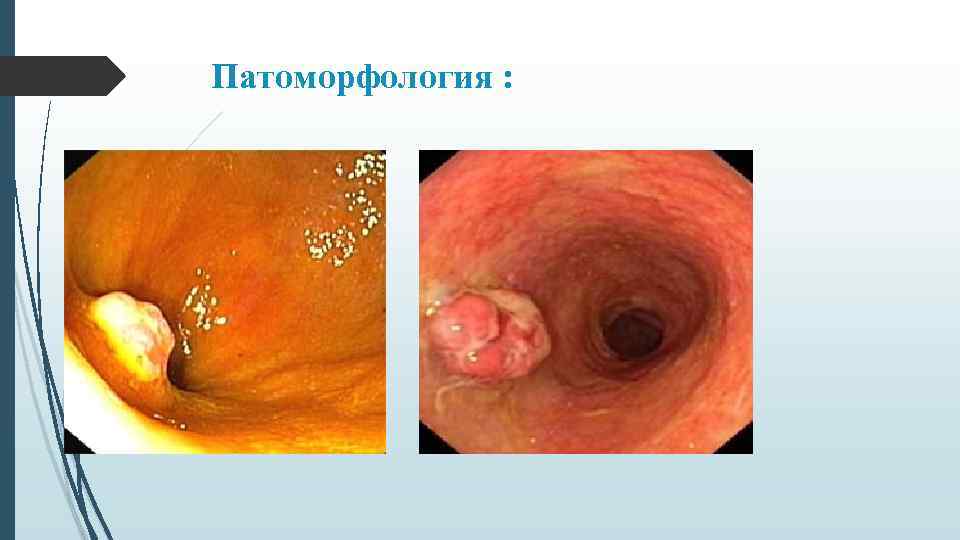 Патоморфология : 