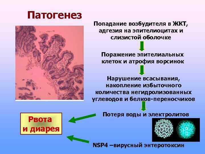 Патогенез Попадание возбудителя в ЖКТ, адгезия на эпителиоцитах и слизистой оболочке Поражение эпителиальных клеток