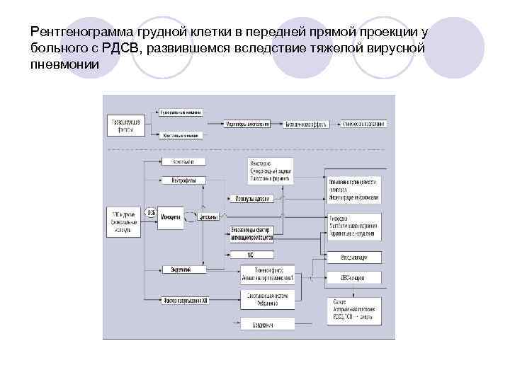 Рентгенограмма грудной клетки в передней прямой проекции у больного с РДСВ, развившемся вследствие тяжелой