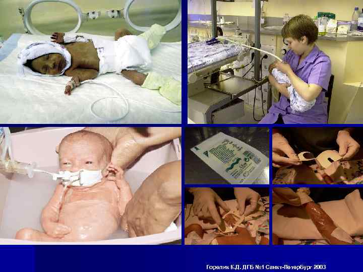 Горелик К. Д. ДГБ № 1 Санкт-Петербург 2003 