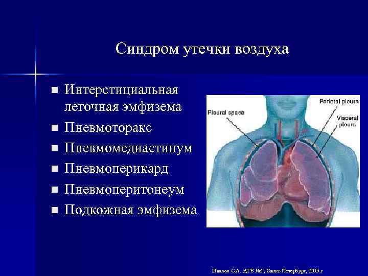 Утечка воздуха. Синдром утечки воздуха у новорожденных. Синдром утечки капилляров. Синдром утечки воздуха у новорожденных патогенез.