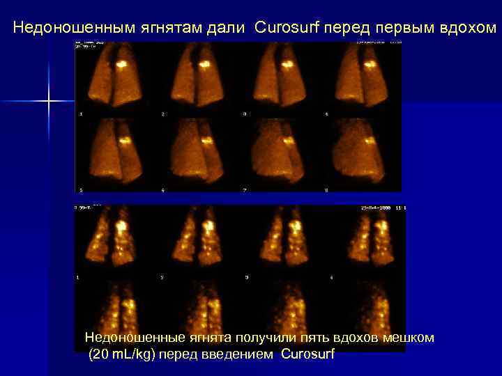 Недоношенным ягнятам дали Curosurf перед первым вдохом Недоношенные ягнята получили пять вдохов мешком (20