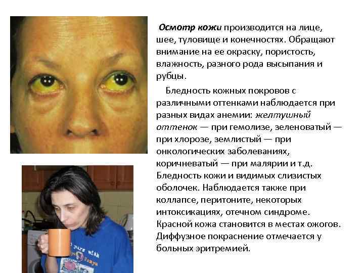 Осмотр кожи производится на лице, шее, туловище и конечностях. Обращают внимание на ее окраску,