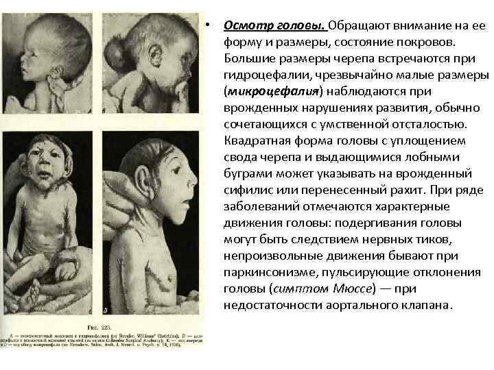  • Осмотр головы. Обращают внимание на ее форму и размеры, состояние покровов. Большие