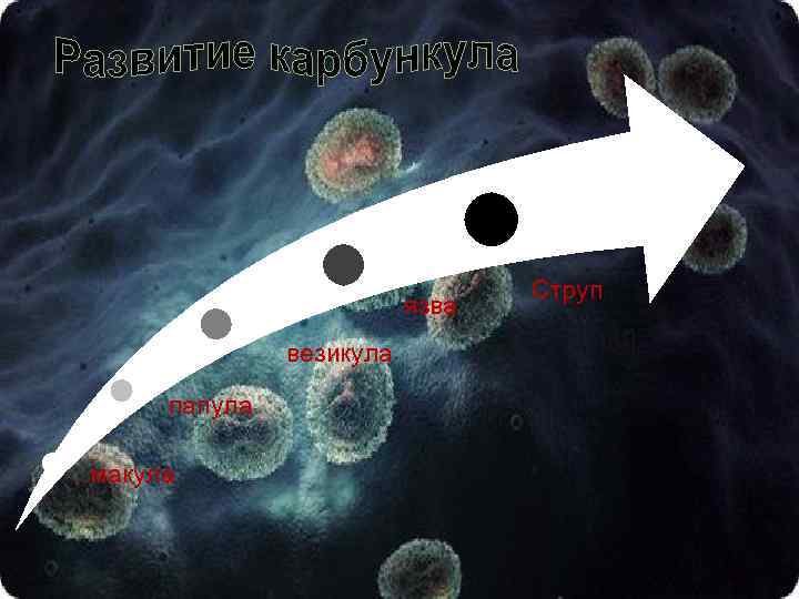 язва везикула папула макула Струп 