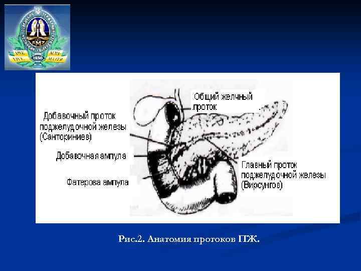 Рис. 2. Анатомия протоков ПЖ. 