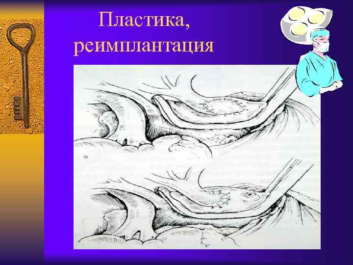 Пластика, реимплантация 