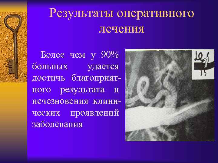 Результаты оперативного лечения Более чем у 90% больных удается достичь благоприятного результата и исчезновения