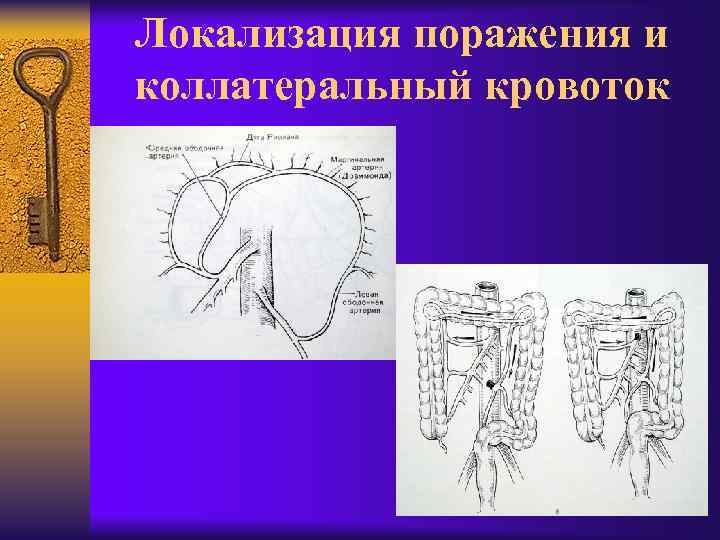 Локализация поражения и коллатеральный кровоток 