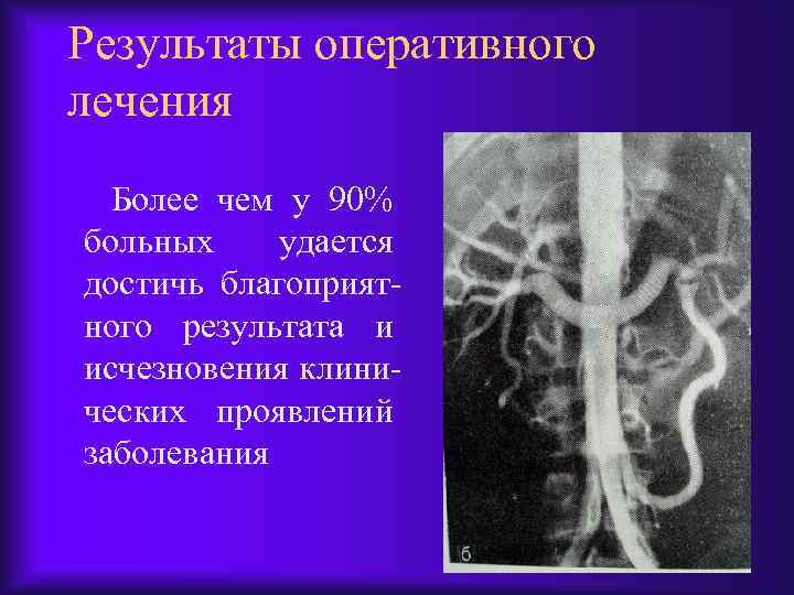 Результаты оперативного лечения Более чем у 90% больных удается достичь благоприятного результата и исчезновения