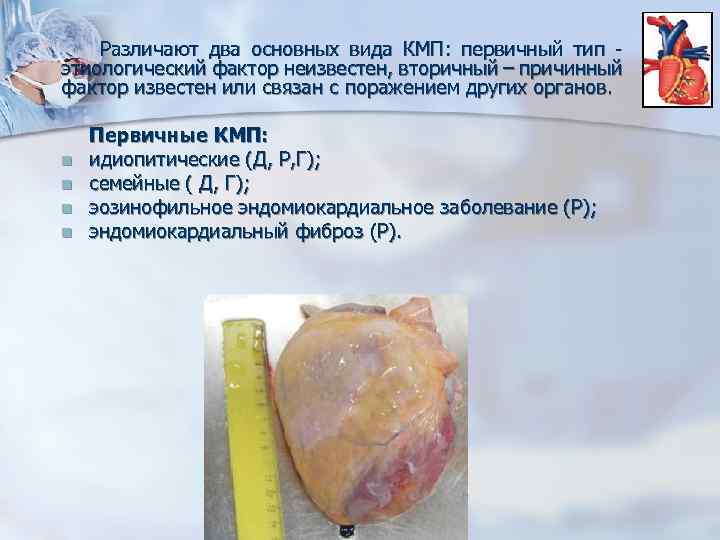  Различают два основных вида КМП: первичный тип этиологический фактор неизвестен, вторичный – причинный