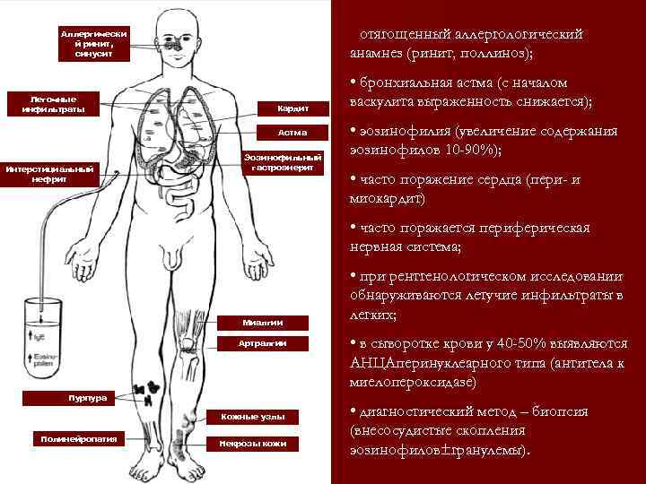 Схема аллергологического анамнеза