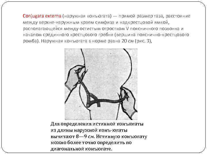 Истинной конъюгатой. Наружная конъюгата методика измерения. Наружная конъюгата методика измерерч. Конъюгата Экстерна размер. Наружная конъюгата в акушерстве.