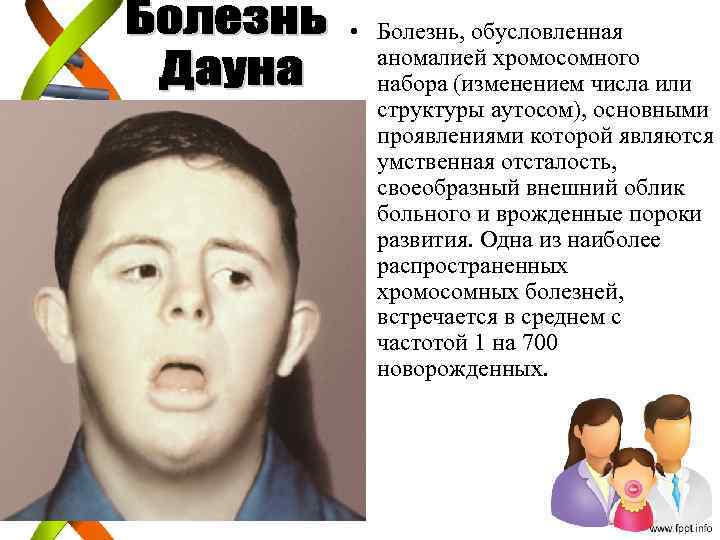  • Болезнь, обусловленная аномалией хромосомного набора (изменением числа или структуры аутосом), основными проявлениями