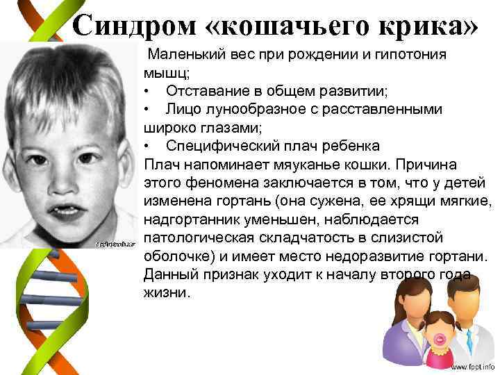 Синдром «кошачьего крика» • Маленький вес при рождении и гипотония мышц; • Отставание в