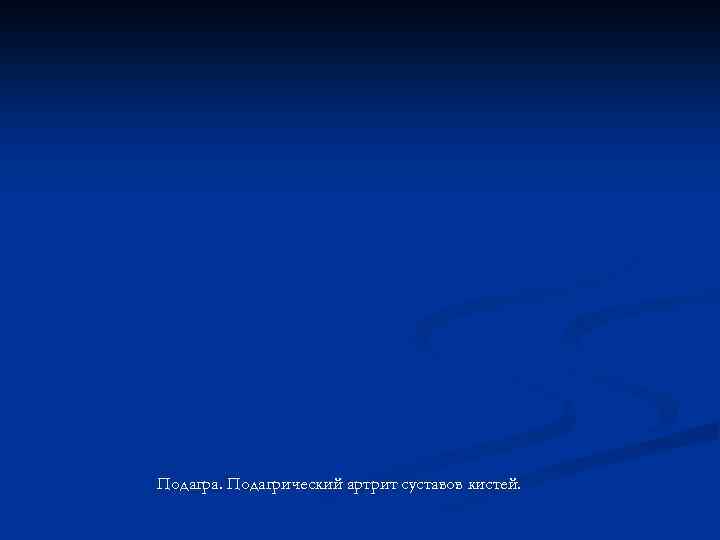 Подагра. Подагрический артрит суставов кистей. 