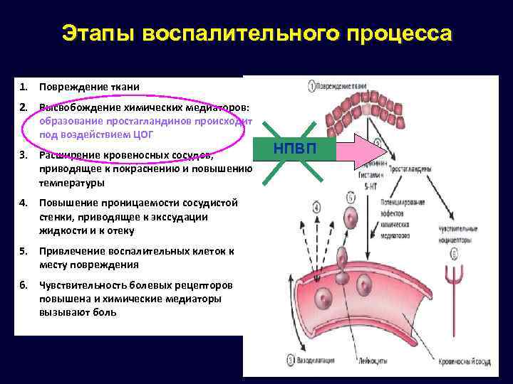 Механизм процесса развития. Этапы воспалительного процесса. Стадии процесса воспаления. Стадии течения воспалительного процесса. Этапы развития воспалительного процесса.