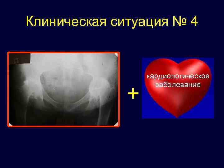 Клиническая ситуация № 4 + кардиологическое заболевание 