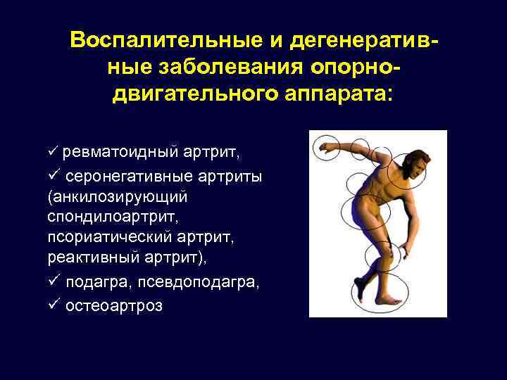 Воспалительные и дегенеративные заболевания опорнодвигательного аппарата: ü ревматоидный артрит, ü серонегативные артриты (анкилозирующий спондилоартрит,
