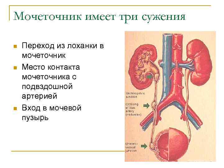 Мочеточник имеет три сужения n n n Переход из лоханки в мочеточник Место контакта