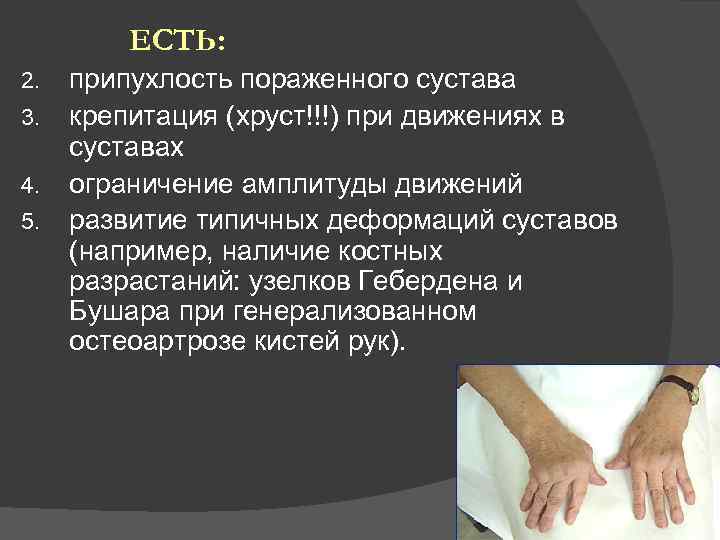 ЕСТЬ: 2. 3. 4. 5. припухлость пораженного сустава крепитация (хруст!!!) при движениях в суставах