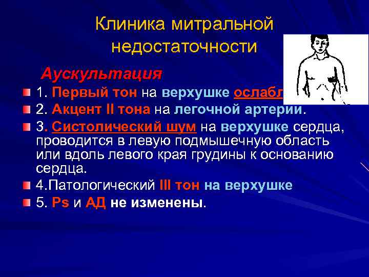 Аускультативная картина недостаточности митрального клапана