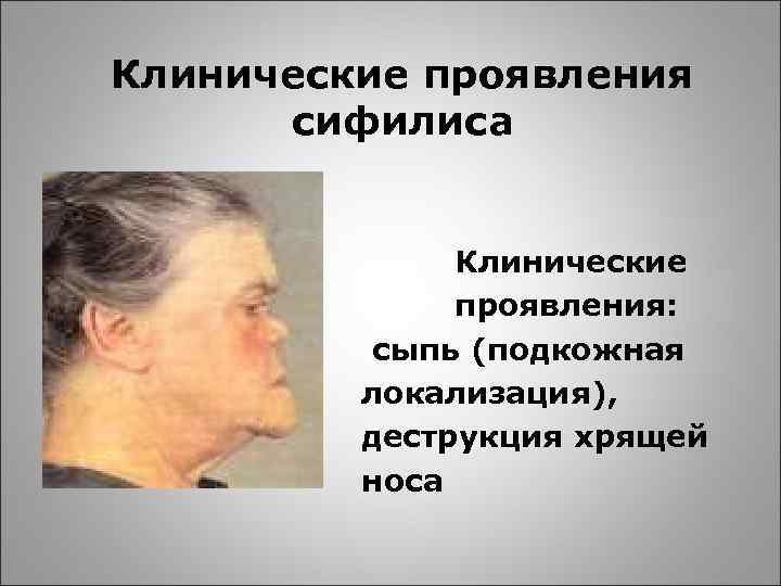 Клинические проявления сифилиса Клинические проявления: сыпь (подкожная локализация), деструкция хрящей носа 