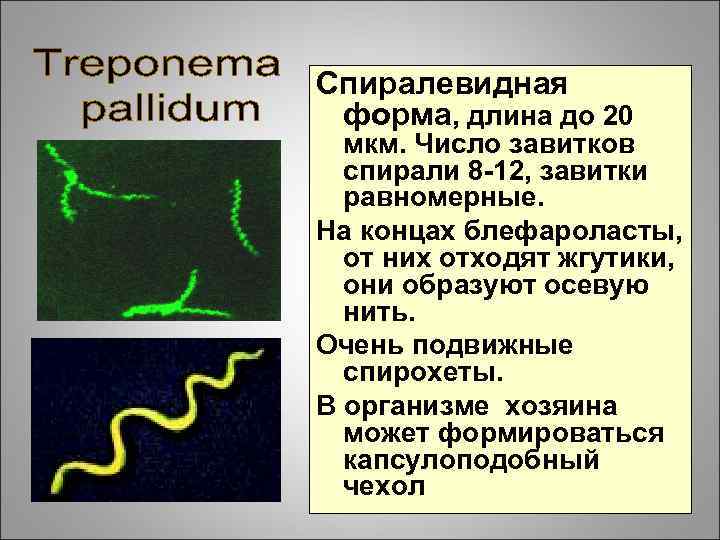 Спиралевидная форма, длина до 20 мкм. Число завитков спирали 8 -12, завитки равномерные. На