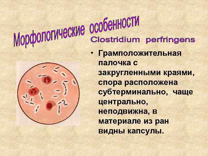  • Грамположительная палочка с закругленными краями, спора расположена субтерминально, чаще центрально, неподвижна, в