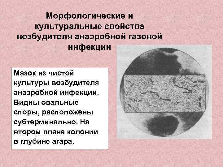 Морфологические и культуральные свойства возбудителя анаэробной газовой инфекции Мазок из чистой культуры возбудителя анаэробной