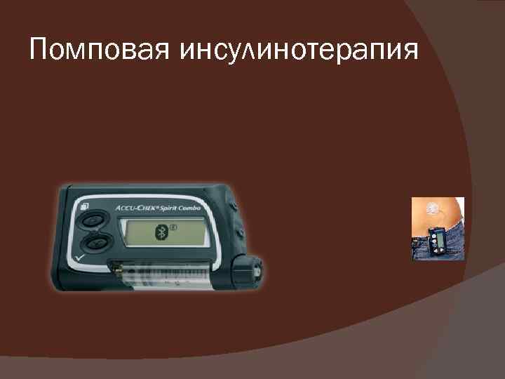 Помповая инсулинотерапия 