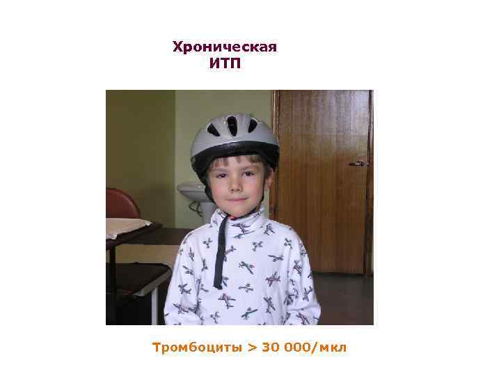 Хроническая ИТП Тромбоциты > 30 000/мкл 