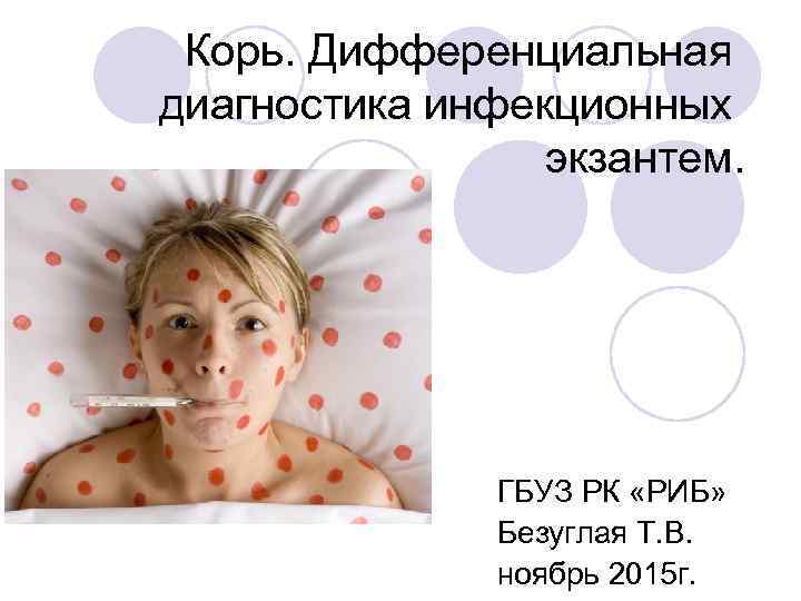 Корь. Дифференциальная диагностика инфекционных экзантем. ГБУЗ РК «РИБ» Безуглая Т. В. ноябрь 2015 г.