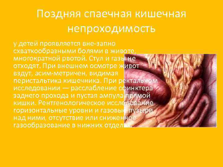 Поздняя спаечная кишечная непроходимость у детей проявляется вне запно схваткообразными болями в животе, многократной