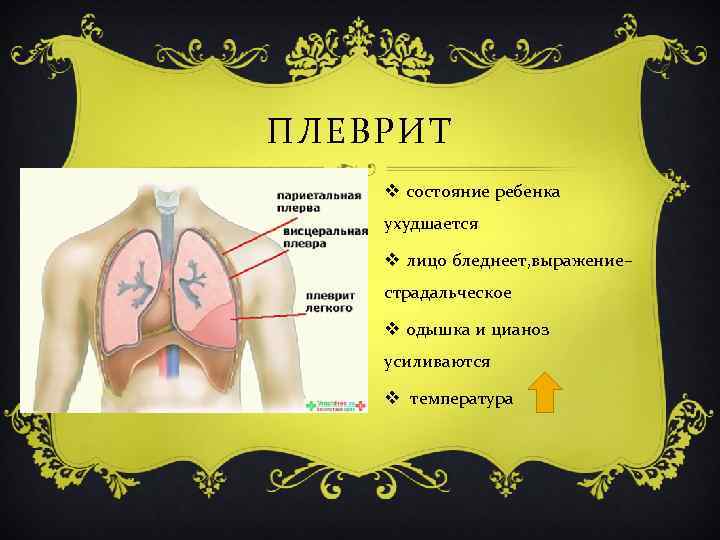 ПЛЕВРИТ v состояние ребенка ухудшается v лицо бледнеет, выражение– страдальческое v одышка и цианоз