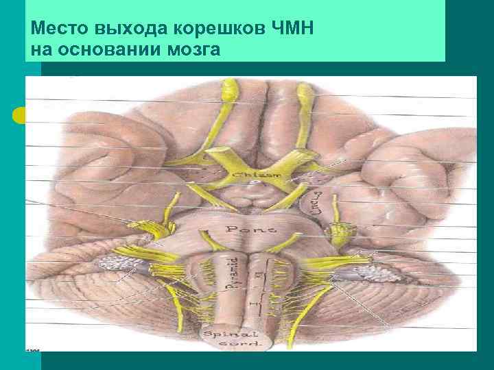 Место выхода корешков ЧМН на основании мозга 