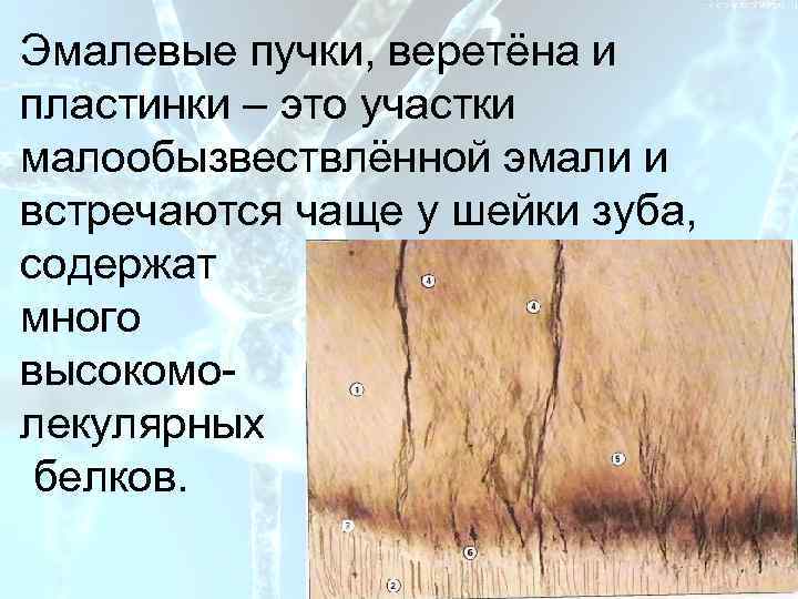 План Эмалевые пучки, веретёна и пластинки – это участки малообызвествлённой эмали и встречаются чаще