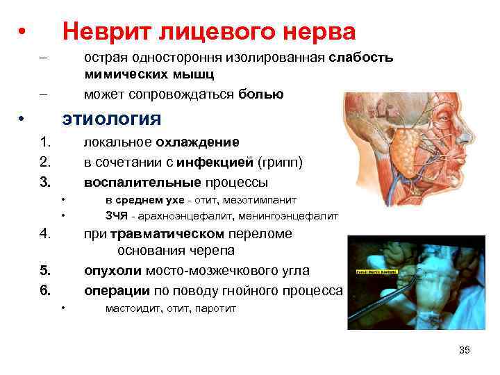 Локальный статус неврит лицевого нерва карта вызова скорой медицинской помощи