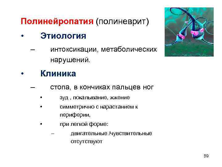 Полинейропатия (полиневрит) • Этиология – • интоксикации, метаболических нарушений. Клиника – стопа, в кончиках