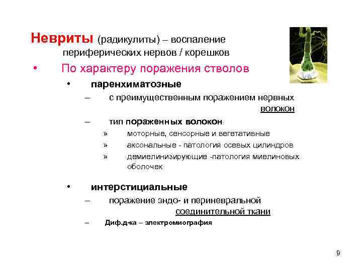 Невриты (радикулиты) – воспаление периферических нервов / корешков • По характеру поражения стволов •