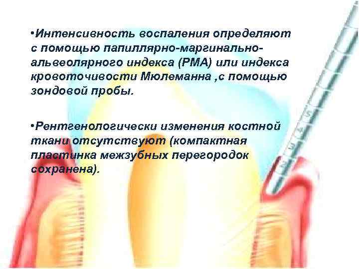  • Интенсивность воспаления определяют с помощью папиллярно-маргинальноальвеолярного индекса (PMA) или индекса кровоточивости Мюлеманна