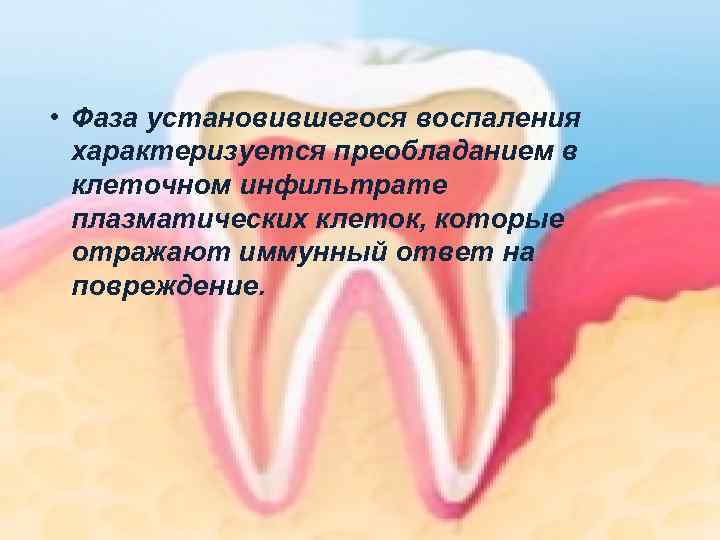  • Фаза установившегося воспаления характеризуется преобладанием в клеточном инфильтрате плазматических клеток, которые отражают