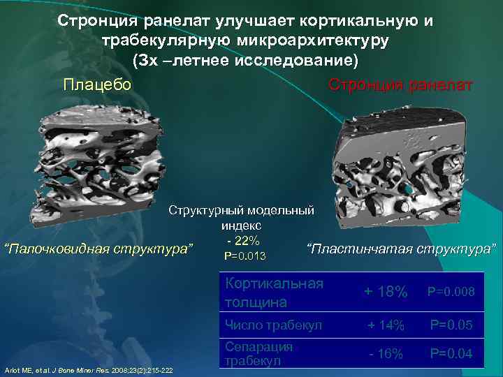 Стронция ранелат улучшает кортикальную и трабекулярную микроархитектуру (Зx –летнее исследование) Плацебо Стронция ранелат Структурный