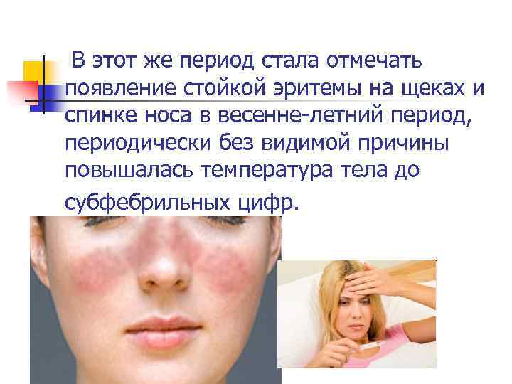 В этот же период стала отмечать появление стойкой эритемы на щеках и спинке носа