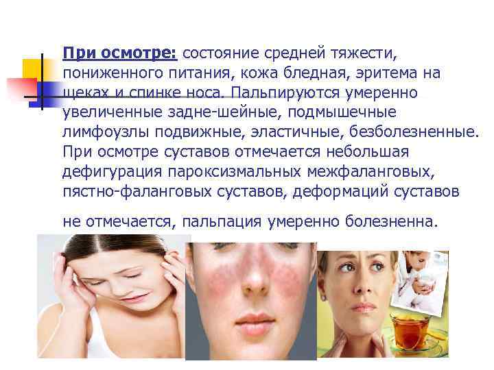 При осмотре: состояние средней тяжести, пониженного питания, кожа бледная, эритема на щеках и спинке