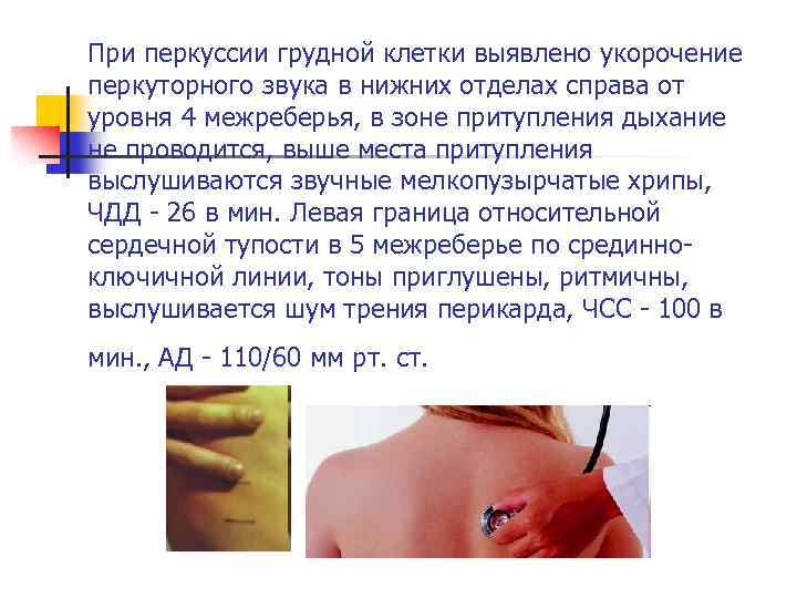 При перкуссии грудной клетки выявлено укорочение перкуторного звука в нижних отделах справа от уровня